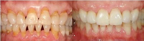 Customer result