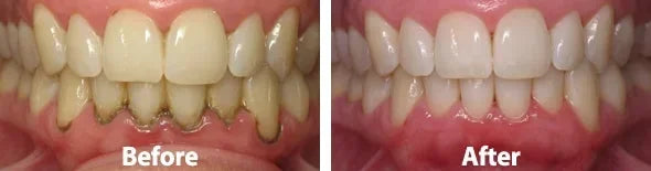Customer result