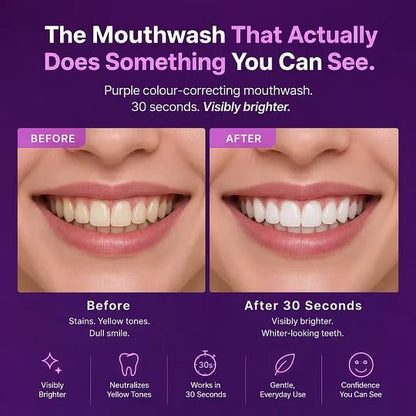 HomiStuff™ Purple Whitening Mouthwash — Bright Smile Formula